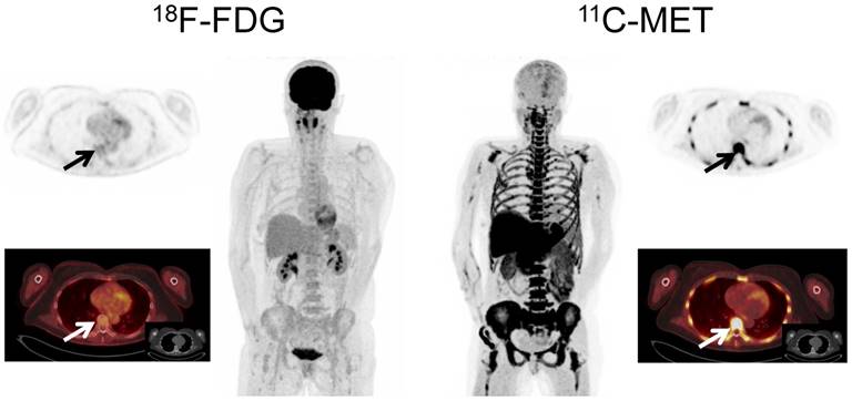 Theranostics Image