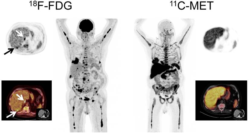 Theranostics Image