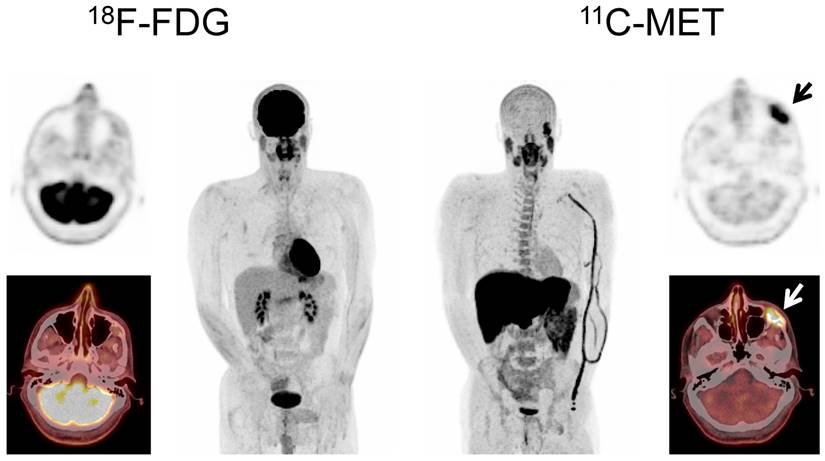 Theranostics Image