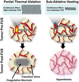 Theranostics Image