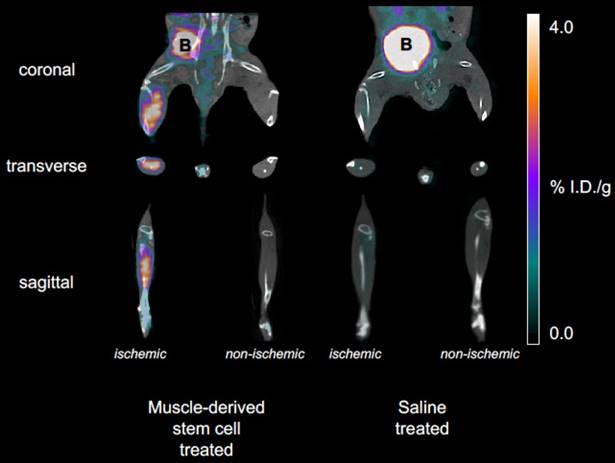 Theranostics Image