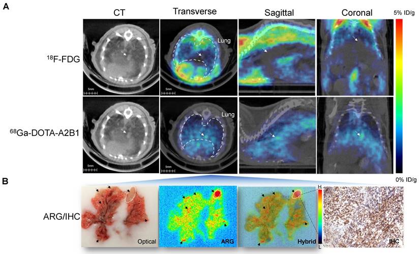 Theranostics Image