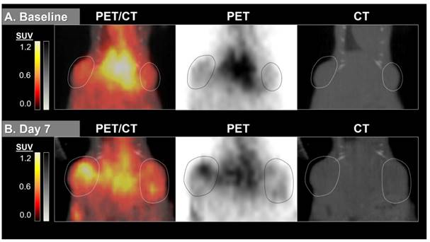 Theranostics Image