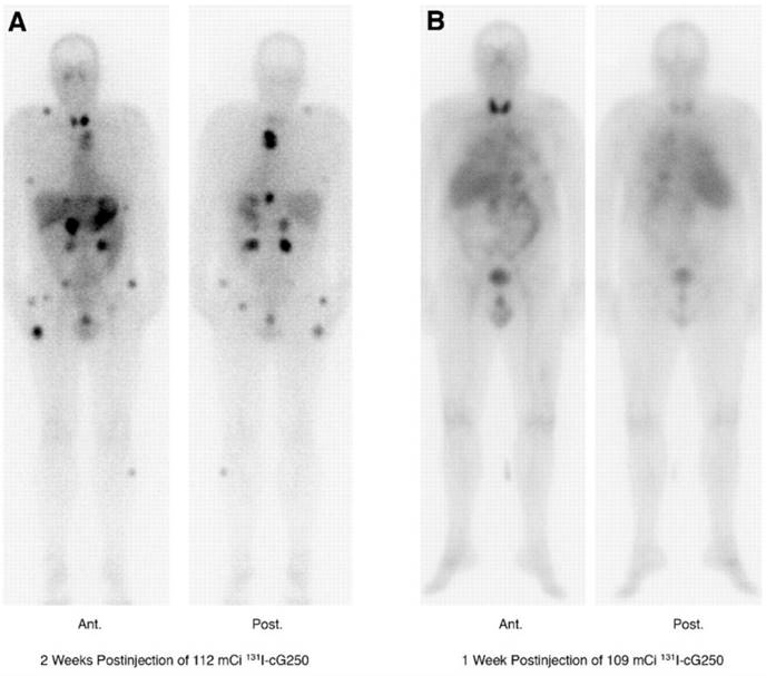 Theranostics Image