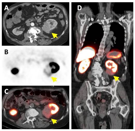 Theranostics Image