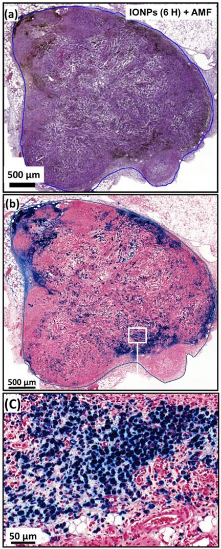 Theranostics Image