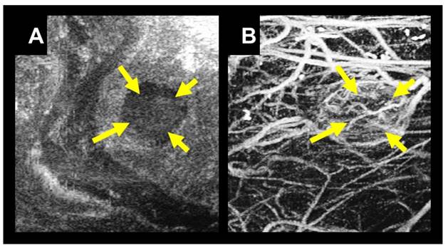 Theranostics Image