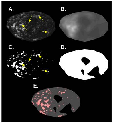 Theranostics Image