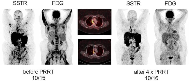 Theranostics Image