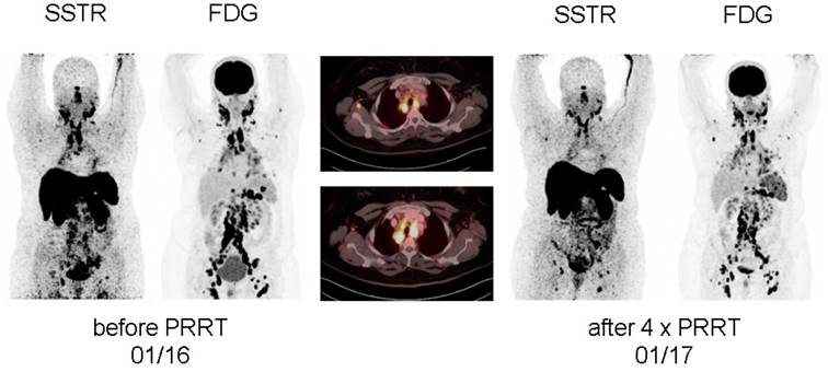 Theranostics Image