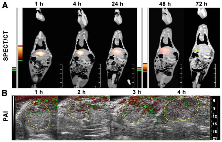 Theranostics Image