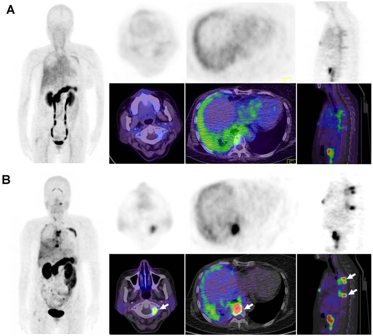 Theranostics Image