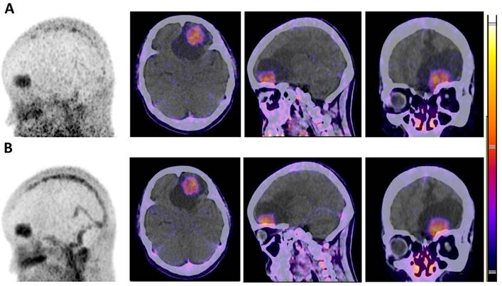 Theranostics Image