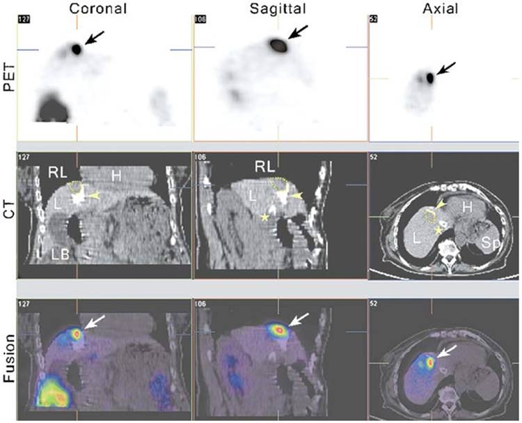 Theranostics Image