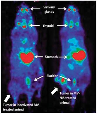 Theranostics Image