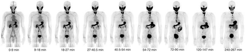 Theranostics Image