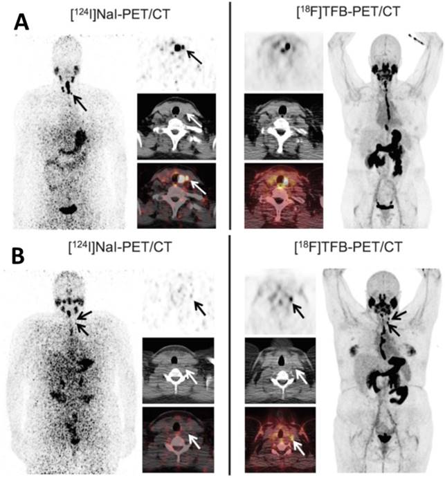 Theranostics Image