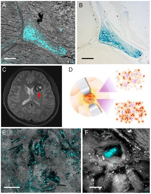 Theranostics Image