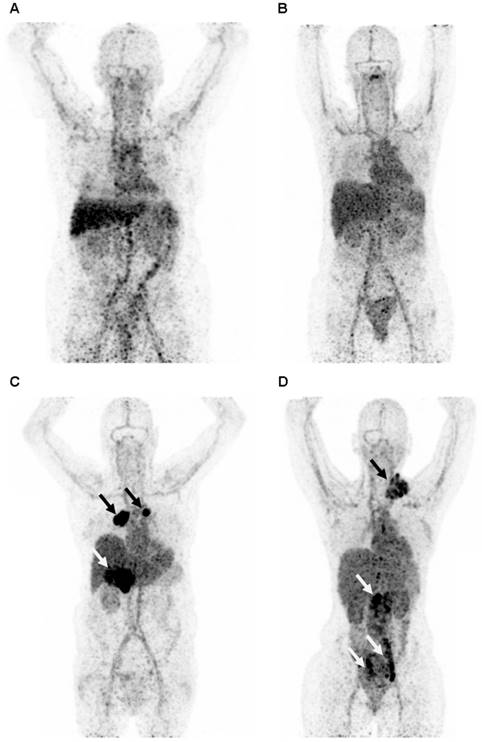 Theranostics Image