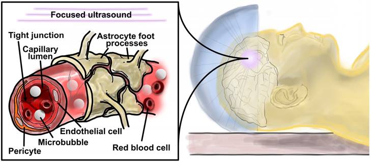 Theranostics Image