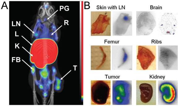 Theranostics Image