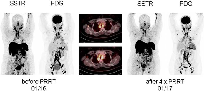 Theranostics Image