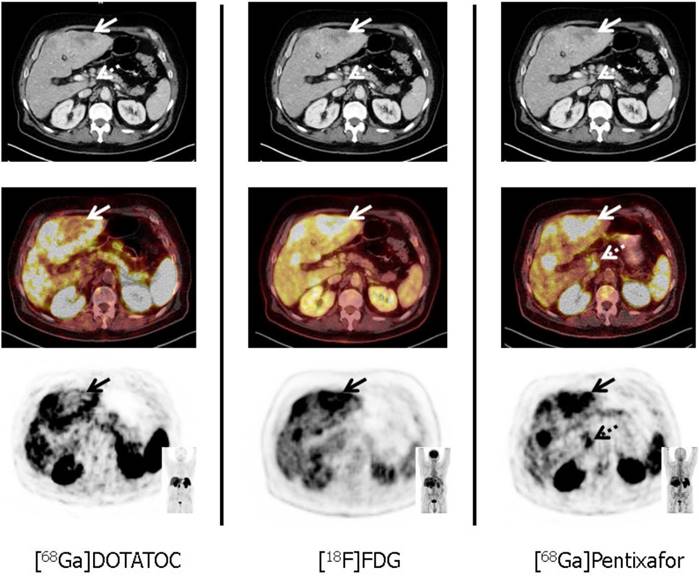 Theranostics Image