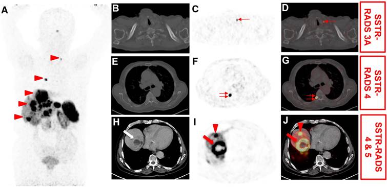 Theranostics Image