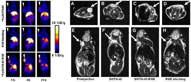 PET-MR and SPECT-MR multimodality probes: Development and challenges