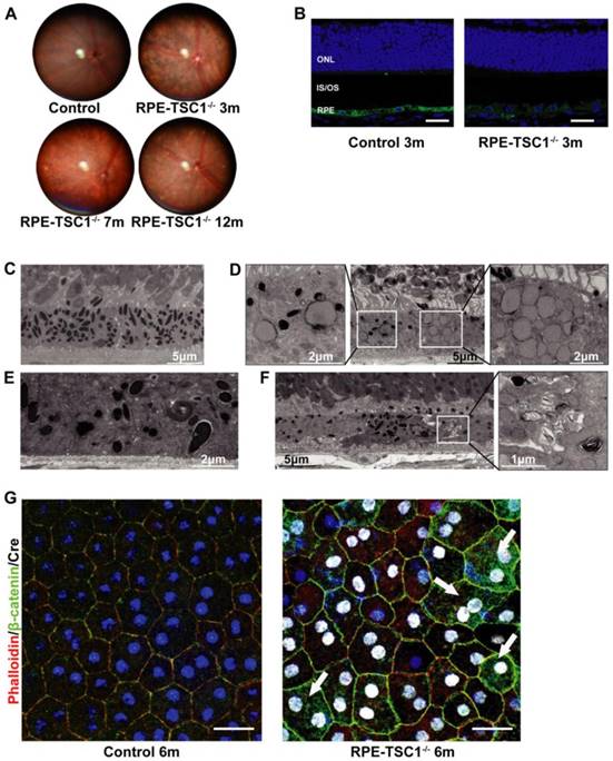 Theranostics Image