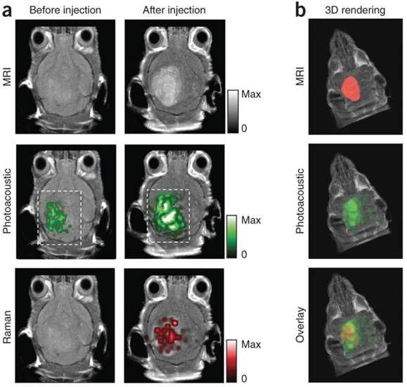 Theranostics Image