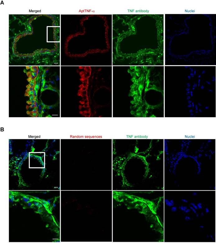 Theranostics Image