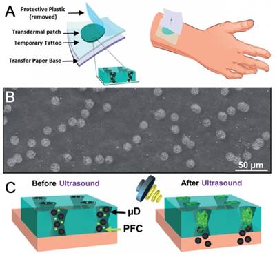 Theranostics Image