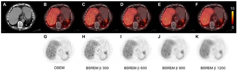 Theranostics Image