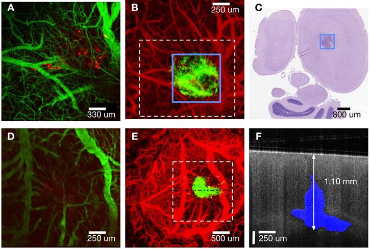 Theranostics Image