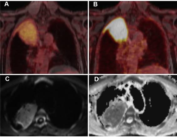 Theranostics Image