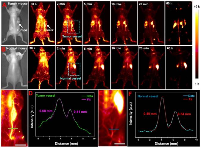 Theranostics Image