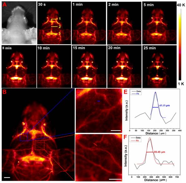 Theranostics Image