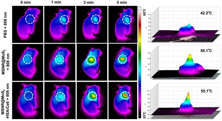 Theranostics Image