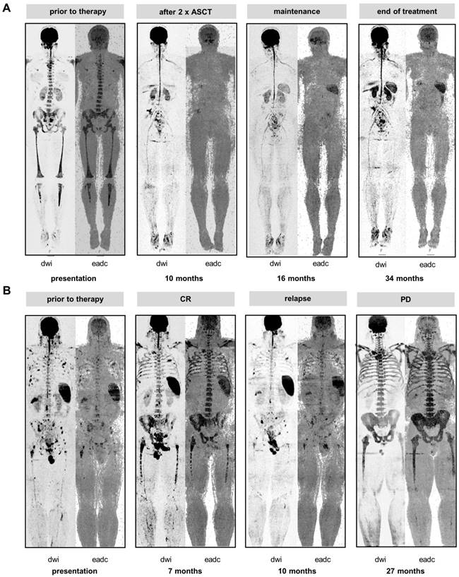 Theranostics Image