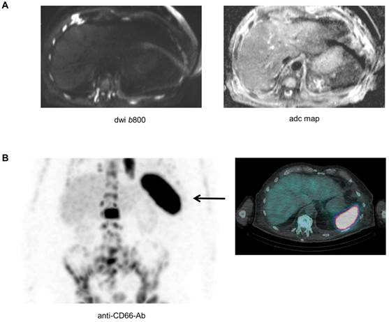 Theranostics Image