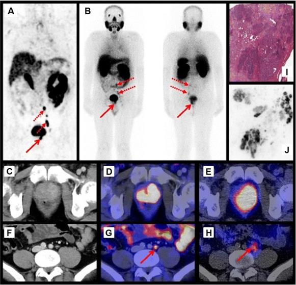 Theranostics Image