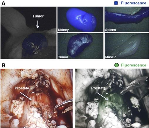 Theranostics Image