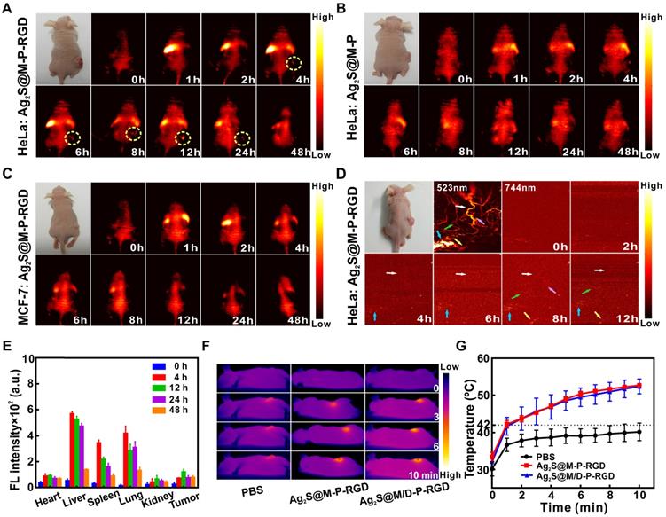 Theranostics Image