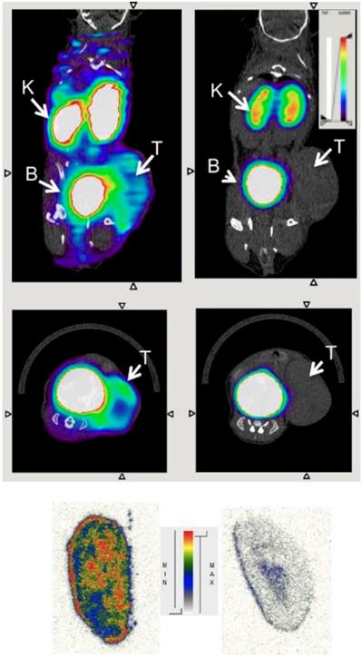 Theranostics Image