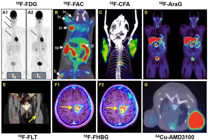 Theranostics Image