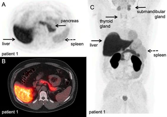 Theranostics Image