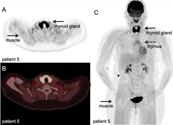 Theranostics Image