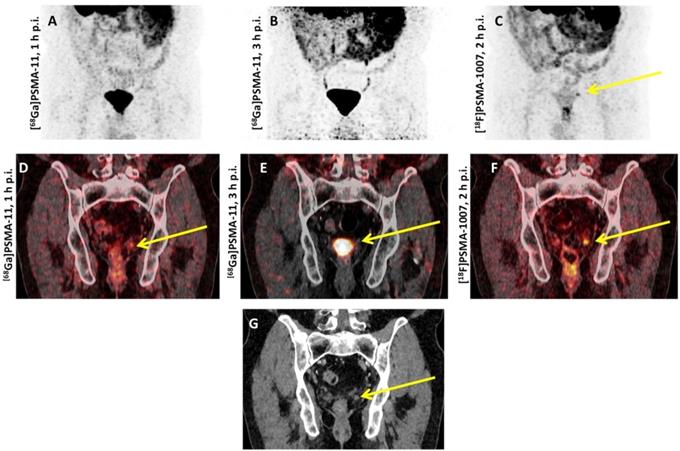 Theranostics Image