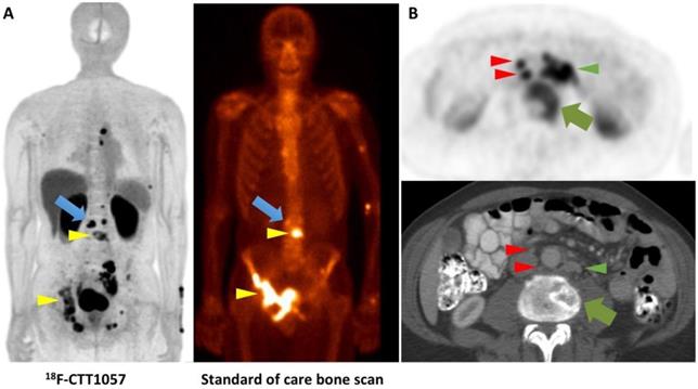 Theranostics Image